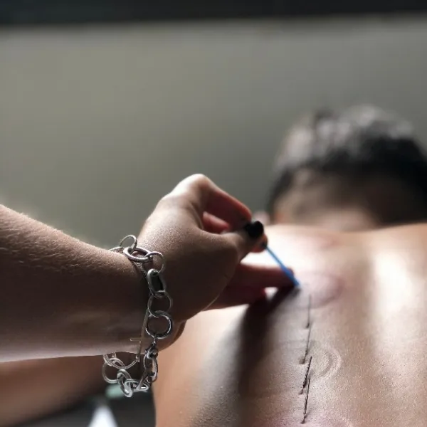 fisioterapia para coluna