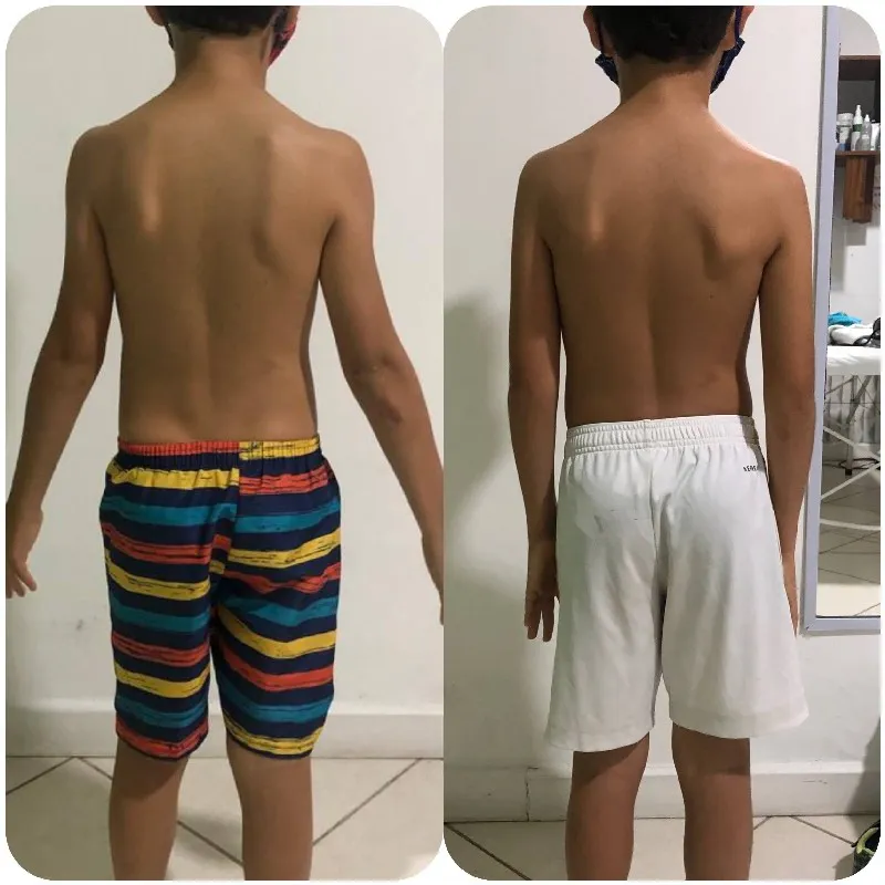 fisioterapia para joelho